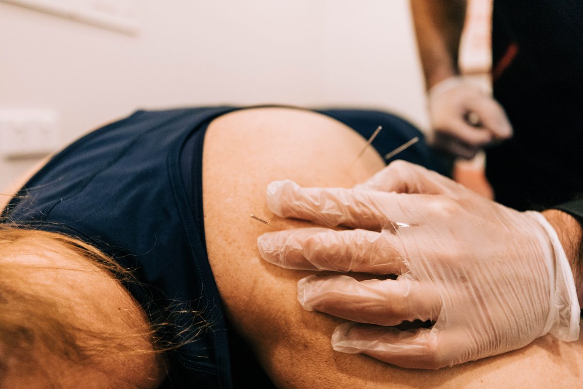 Dry needling physio melbourne 