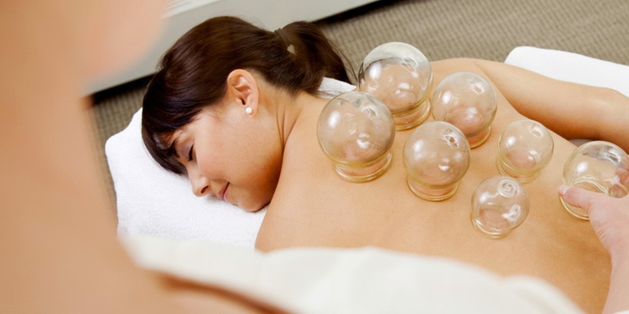 Cupping therapy Melbourne