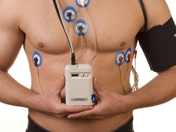 Holter monitor test Sydney