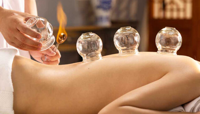 cupping therapy melbourne