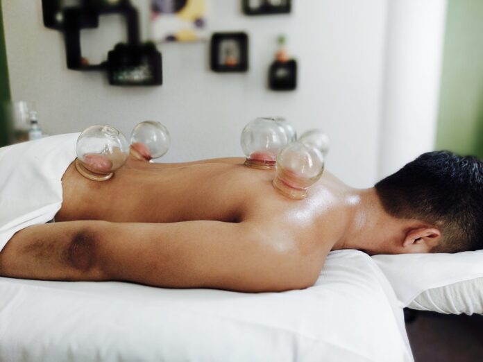 cupping therapy melbourne