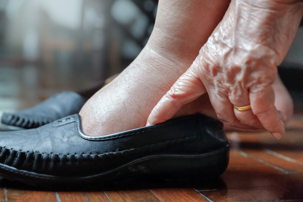 Shoes For People With Swollen Feet