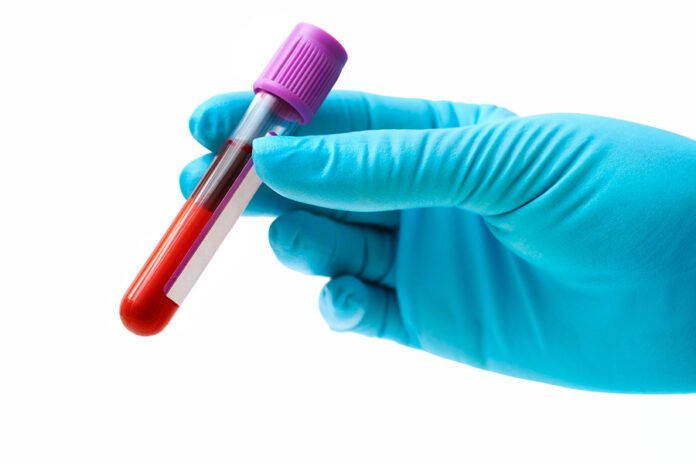 Live Blood Analysis Melbourne